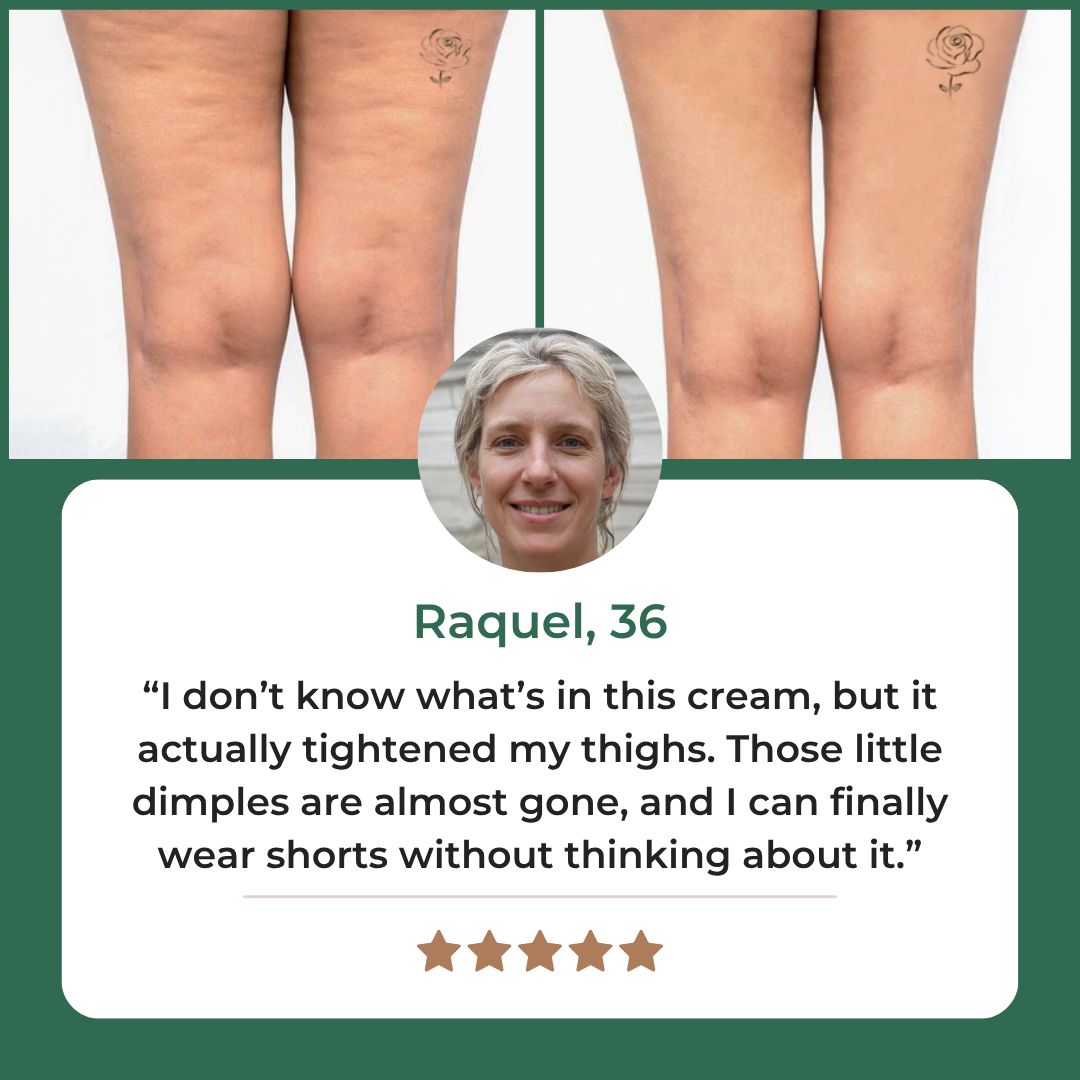 Novalis™ Advanced Crepey Skin Repair Cream