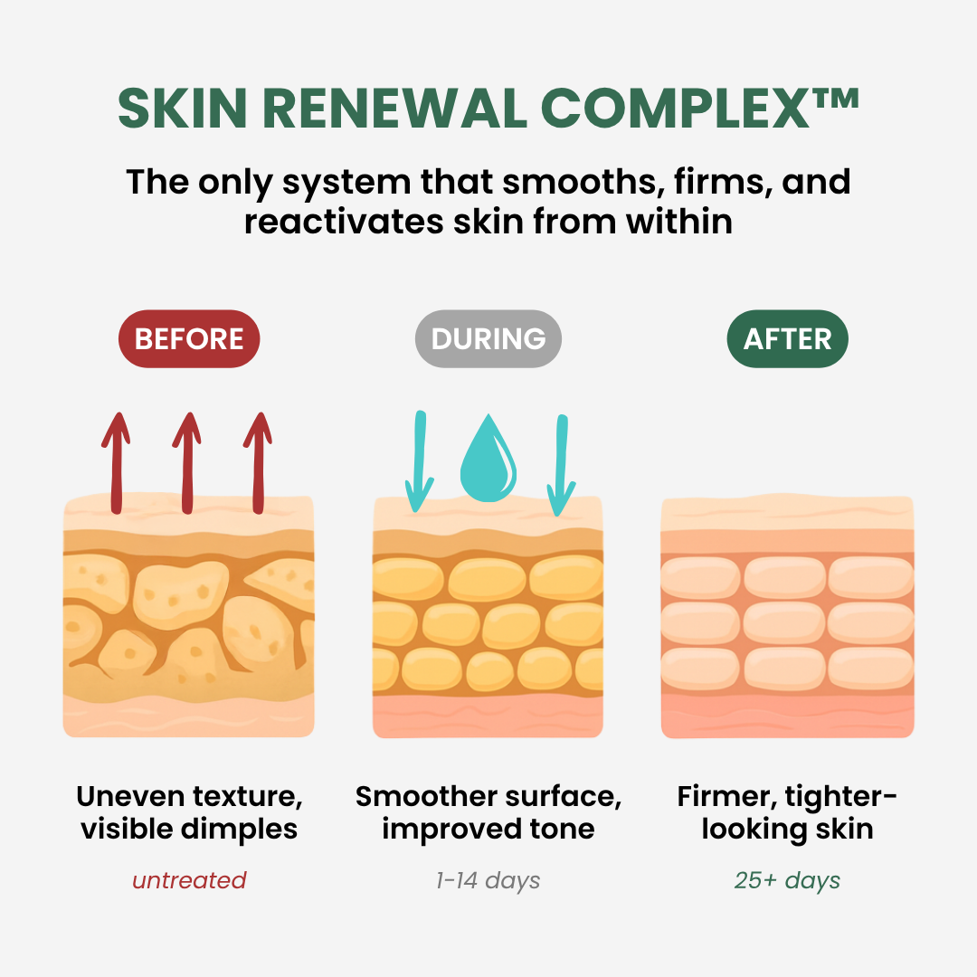 Novalis™ Advanced Crepey Skin Repair Cream